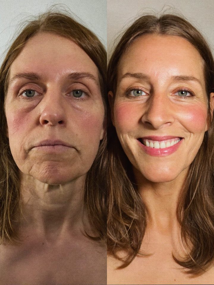 Customer before and after result