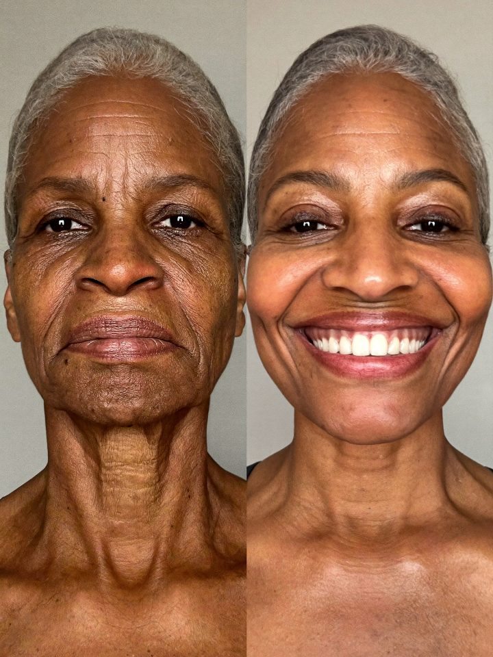 Customer before and after result