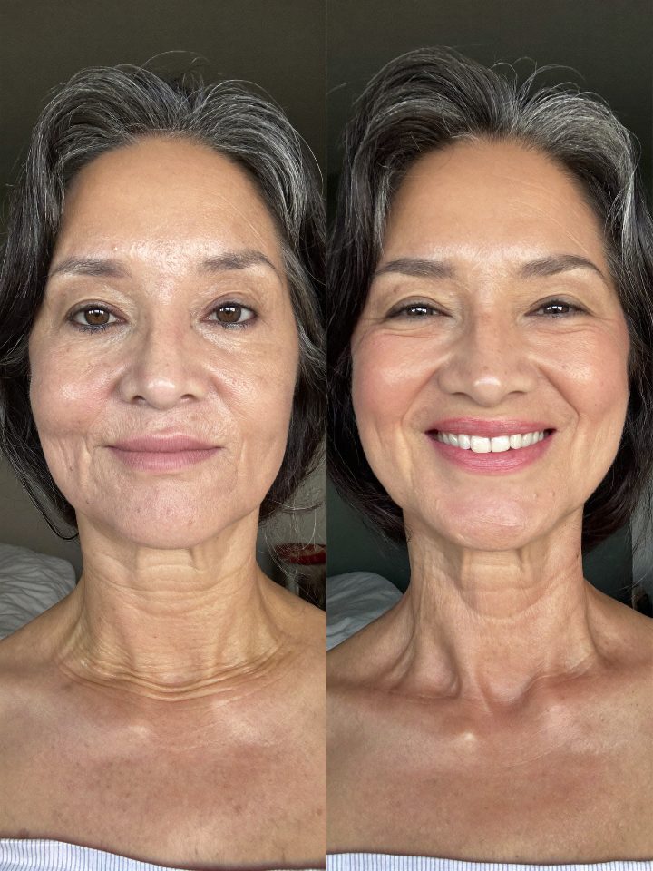 Customer before and after result