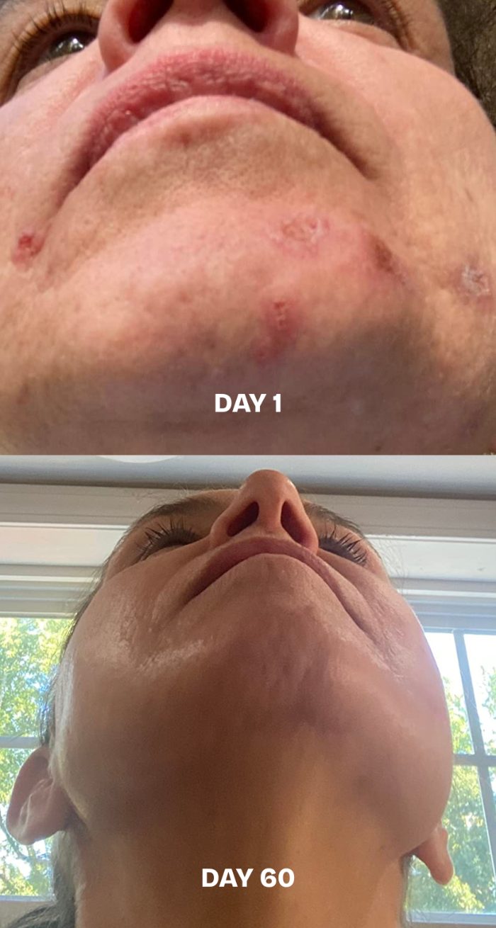 Progress from Day 1 to Day 60